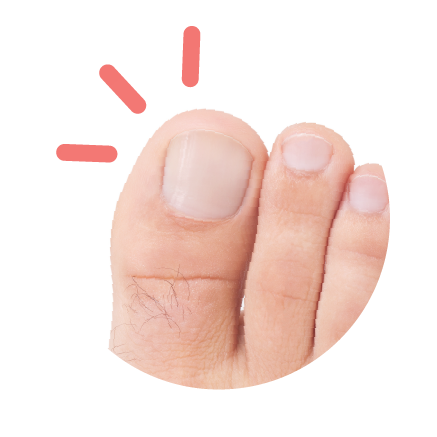 painful big toe